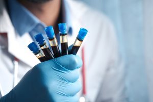 Probówki z próbkami krwi do badań laboratoryjnych